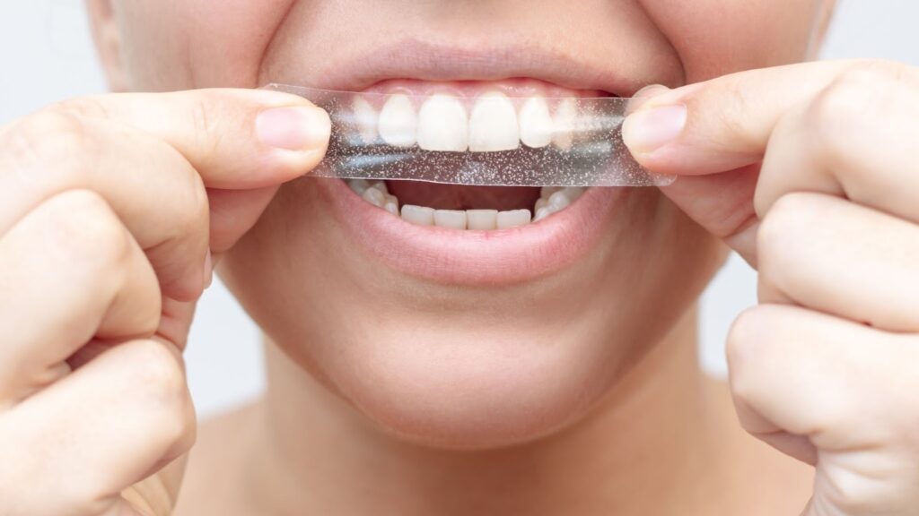 Your Complete Guide to Post Braces Smile Care
